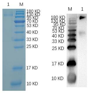 Reducing 12% SDS-PAGE and WB analysis profile of purified IGF1R-01P.